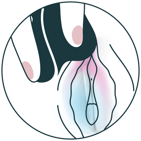 MEA auf der Klitoris platzieren